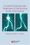 Current Endovascular Treatment of Abdominal Aortic Aneurysms