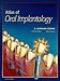 Books : Atlas of Oral Implantology