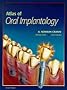 Atlas of Oral Implantology