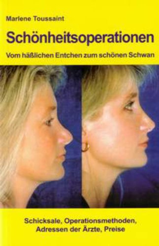 Schönheitsoperationen -Vom hässlichen Entchen zum schönen Schwan (German Edition)