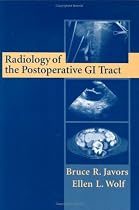 Radiology of the Postoperative GI Tract