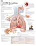 COPD/Asthma chart: Wall Chart