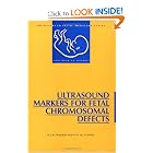 Ultrasound Markers for Fetal Chromosomal Defects (Frontiers in Fetal Medicine) by Rosalinde J.M. Snijders and K.H. Nicolaide