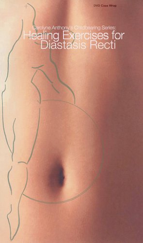 Healing Exercises for Diastasis Recti