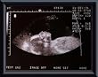 Art Poster Metal Framed Print - Ultra Sound Baby - Artist: John Mottern- Poster Size: 8 X 10