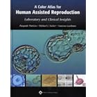 Click here to buy A A Color Atlas for Human Assisted Reproduction: Laboratory and Clinical Insights by Pasquale Patrizio, Michael J Tucker, and Vanessa Guelman.