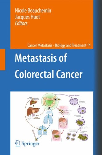 Metastasis of Colorectal Cancer (Cancer Metastasis - Biology and Treatment)