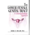 The Lower Female Genital Tract: A Clinicopathologic Approach by  Debra S. Heller