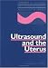 Book Ultrasound and the Uterus (Progress in Obstetric and Gynecological Sonography Series, Vol 2)