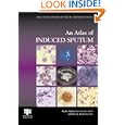 An Atlas of Induced Sputum: An Aid for Research and Diagnosis (Encyclopedia of Visual Medicine Series) by Ratko. Djukanovic and Peter Sterk