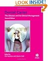 Dental Caries: The Disease and Its Clinical Management