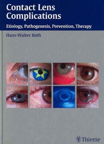 Contact-Lenses