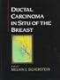 Ductal Carcinoma in Situ of the Breast