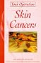 Skin Cancers (Your Operation)