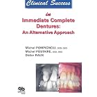 Clinical Success in Immediate Complete Dentures: An Alternative Approach by Michel Pompignoli, Michel Postaire, and Didier Raux