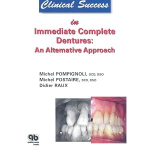 Click here to buy Clinical Success in Immediate Complete Dentures: An Alternative Approach by Michel Pompignoli, Michel Postaire, and Didier Raux.