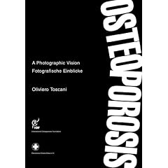 Osteoporosis /Osteoporose: A Photographic Vision /Fotografische Einblicke