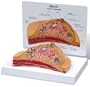 Breast Cross Section Model