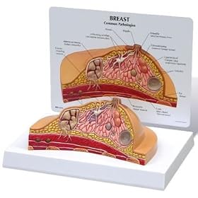 Click here to buy Breast Cross Section Model by Anatomical Chart Company.