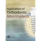 Applications of Orthodontic Mini-Implants by Jong Suk, Ph.D. Lee, Jung Kook, Ph.D. Kim, Young-Chel Park, and Robert L. Vanarsdall