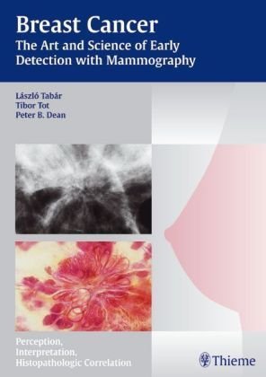 Breast Cancer - The Art and Science of Early Detection with Mammography: Perception, Interpretation, Histopathologic Correlation: Pathology, Patterns and Perception