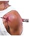 Fx Halloween Prosthetics - Spiked Costume Accessory