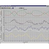 Compare Prices of weatherlink davis-06510X Extra User License Kit, WeatherLink for Vantage On Sale