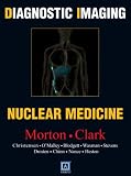 Diagnostic Imaging: Nuclear Medicine