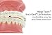 Our Bestseller Orthodontic Braces LipGuard Protector Shield (1 set - Upper - Lower teeth) with Instructions By Cayenas