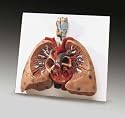 Lungs with Heart  JS6530