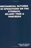 Mechanical Sutures in Operations on the Stomach, Biliary Tree and Pancreas