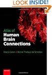Atlas of Human Brain Connections