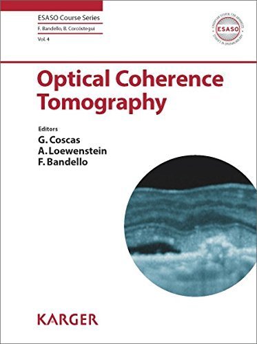 Optical Coherence Tomography - an Update (ESASO Course Series, Vol. 4) (2014-01-31)