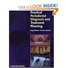 Practical Periodontal Diagnosis and Treatment Planning by Serge Dibart and Thomas Dietrich