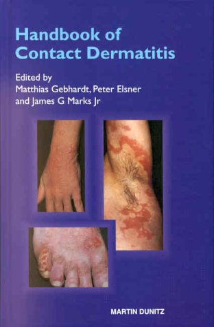 Dermatitis