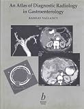 An Atlas of Diagnostic Radiology in     Gastroenterology