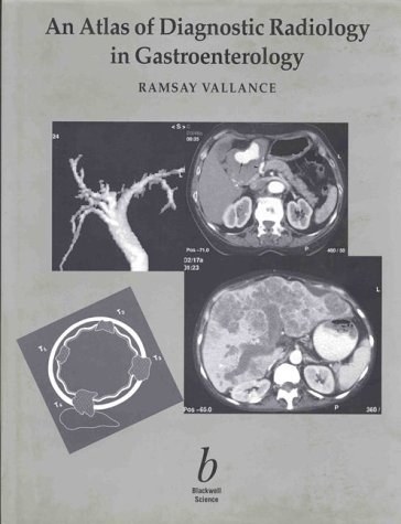 Digestive-Diseases