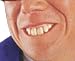 Big Bubba Mr Groovy Teeth Costume Accessory