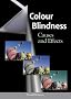 Colour Blindness: Causes and Effects