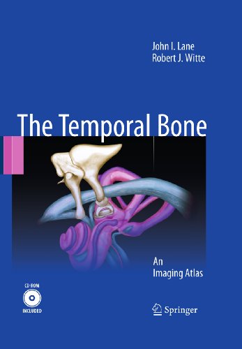 Temporal Bone: An Imaging Atlas On Sale