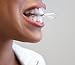 Teeth Whitening Gel with Tray - Instantly Whiter Brighter Teeth - Best Whitener Available - Makes Every Tooth as White as Possible
