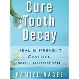 Cure Tooth Decay: Heal And Prevent Cavities With Nutrition - Limit And Avoid Dental Surgery and Fluoride