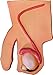 Herindera Testicular Cancer RS.1500.00