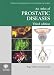 Book An Atlas of Prostatic Diseases, Third Edition (Encyclopedia of Visual Medicine Series)