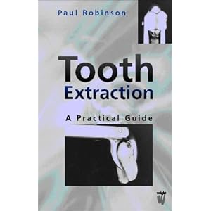 Click here to buy Tooth Extraction: A Practical Guide by Paul D. Robinson PhD BDS MBBS FDS.