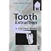 Tooth Extraction: A Practical Guide