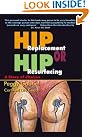 Hip Replacement or...