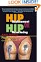 Hip Replacement or Hip Resurfacing: A Story of Choices