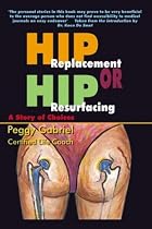 Hip Replacement or Hip Resurfacing: A Story of Choices