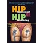 Hip Replacement or Hip Resurfacing: A Story of Choices